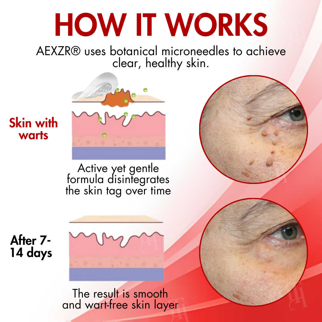🩹 AEXZR® Nano-Microdart Skin Tag Patches — Painless Removal in 3-7 Days, Dual-Action Repair, No Scarring