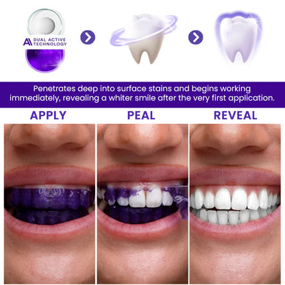 🦷 AEXZR® V34 Whitening Strips —Visible Results in 30 Minutes, No-Slip Design, Enamel-Safe & Sensitivity-Free